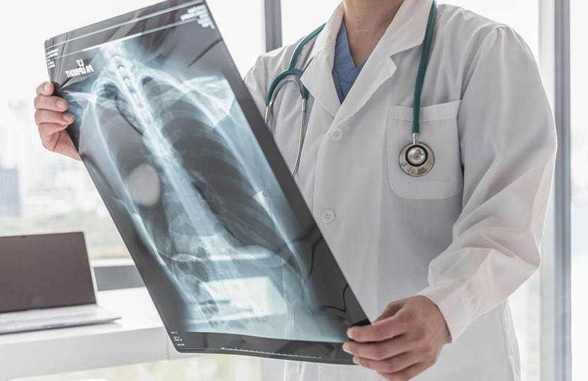 Stock photo showing a doctor's torso with hands holding an x-ray.