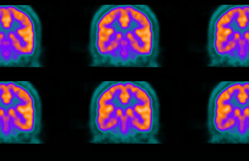 A colorful collage of purple, orange and turquoise images of a brain