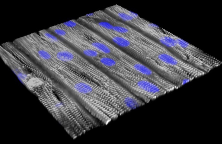 Flat sheet with gray muscle fibers and purple nuclei