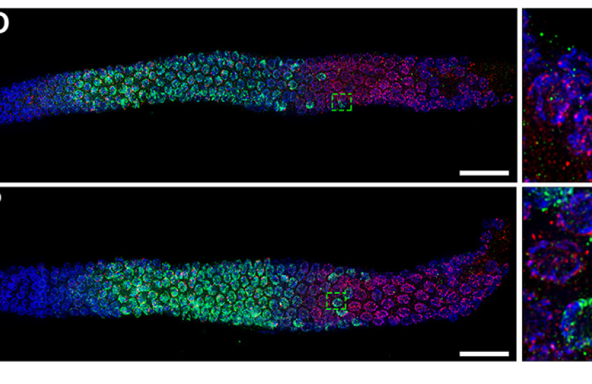 Two images of cells throughout worm bodies are colored blue, green and pink. Each has an inset box detailing normal and abnormal features in a single egg.