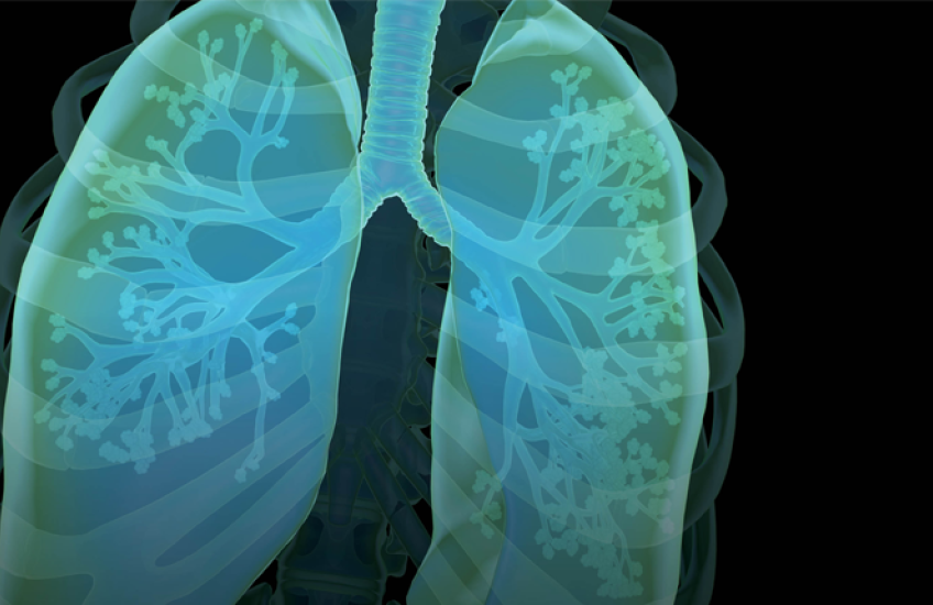 Lungs