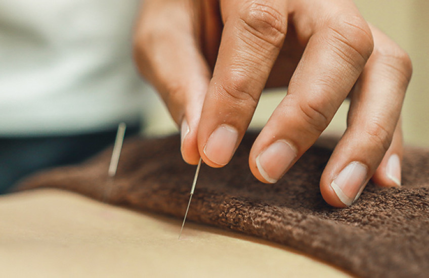 acupuncture needles being inserted in a patient