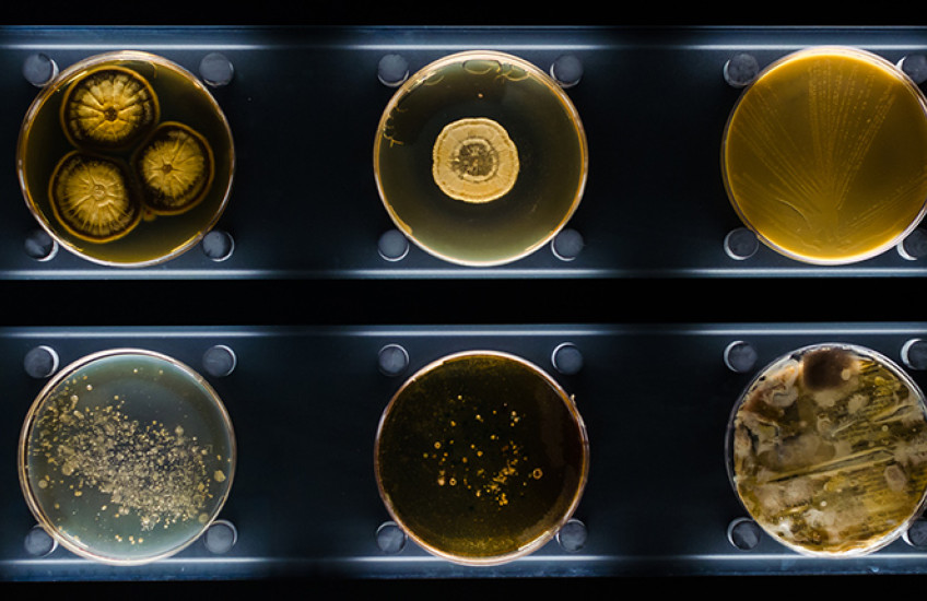 six Petri dishes containing different types of bacteria