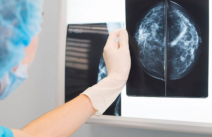 A clinician (a doctor or a nurse) looks at an X-ray scan of breast cancer