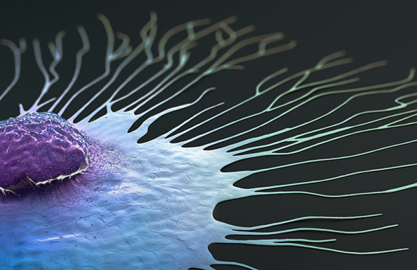 Digital illustration of a single breast cancer cell spreading