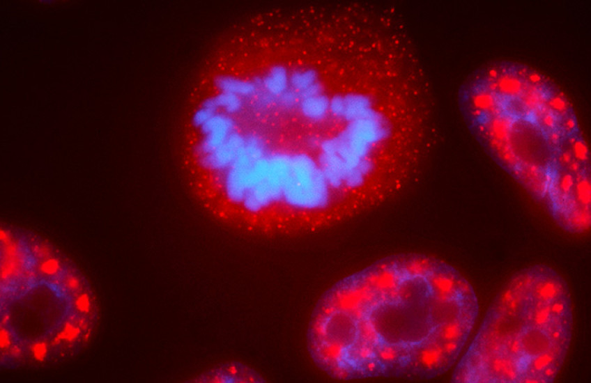 microscopy image of a cell nucleus showing distinct compartments