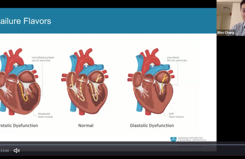 screen grab of Chang on video screen and slide with digital illustrations of a heart
