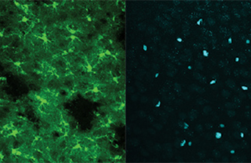 four microscopy images in green, purple and blue
