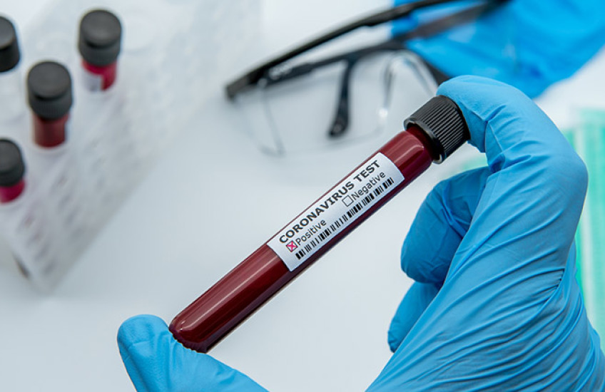 test tube held by gloved hand; label on test tube indicates a positive coronavirus test