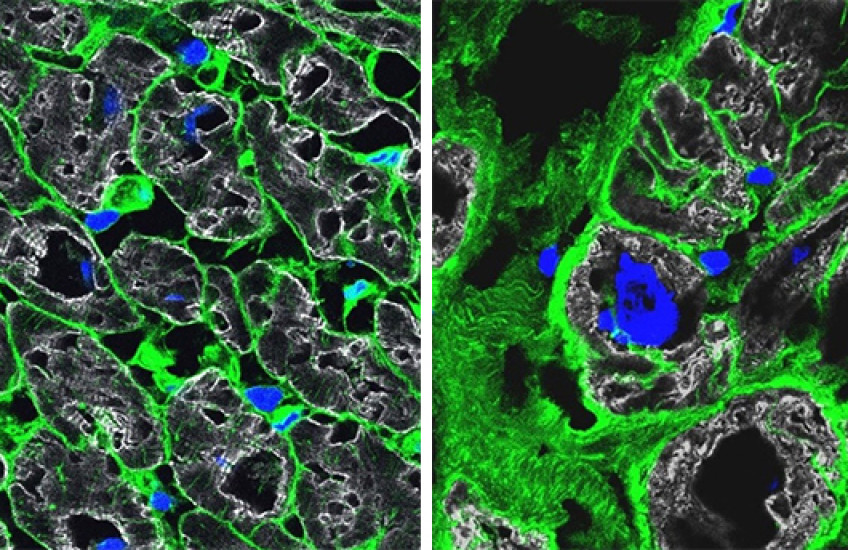 Microscopy shows cells in green and nuclei in blue