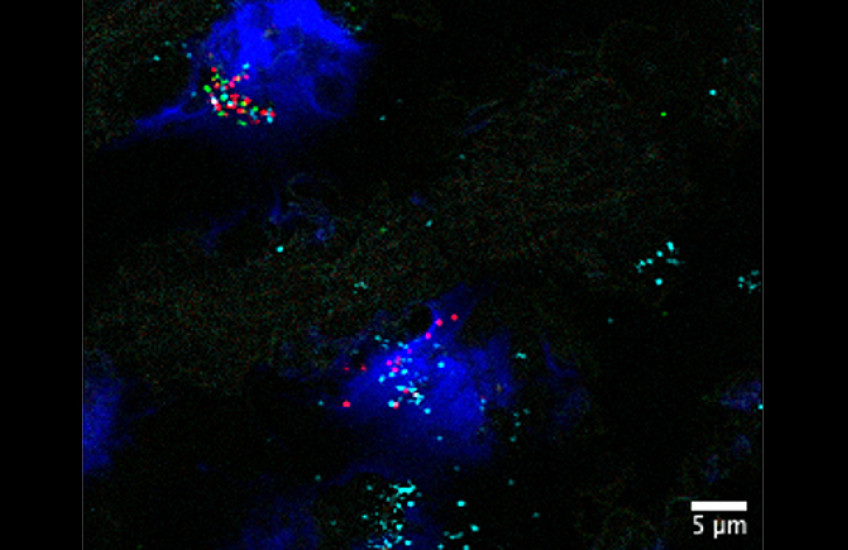 Microscope image with two dark blue blobs against a black background. Within the blobs are a scattering of green, blue and red dots.