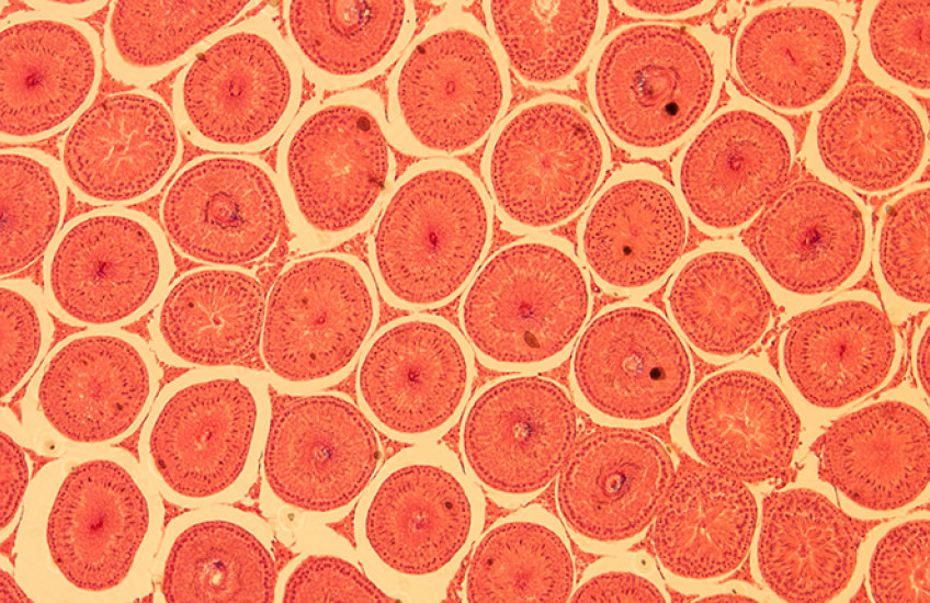 cross-sections of orange-stained spheres