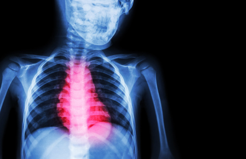 Illustration of reddened heart against blue skeleton X-ray