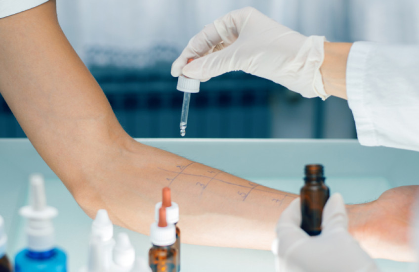 Photo of a doctor administering an allergy test on someone's arm
