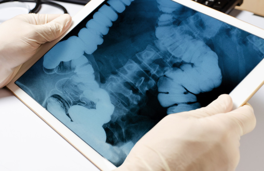 Two hands wearing white latex gloves hold a tablet showing an X-ray image of intestines and spine
