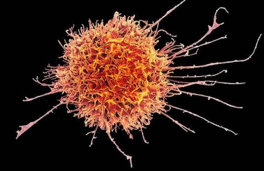 Cell colorized red-orange with spikes and tendrils against a black background