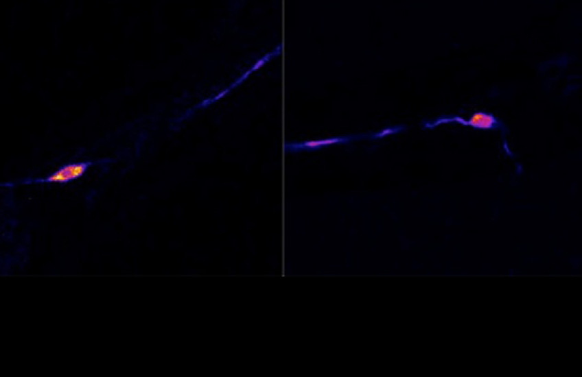Two neurons shown side by side have different rates of subtle flashing