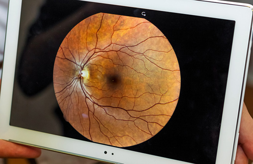 image of ocular funds being presented on an iPad 
