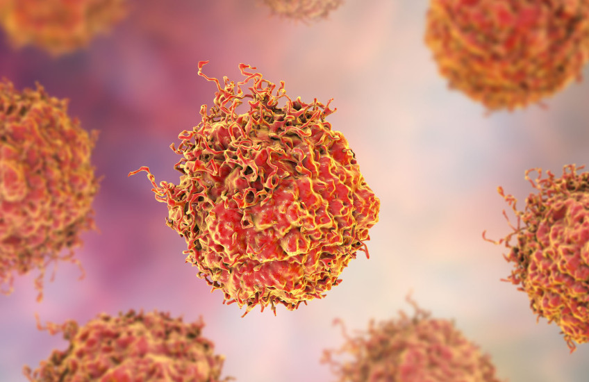 Prostate Cancer Cells