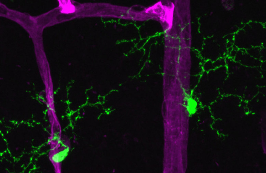 retinal microglia and retinal vasculature