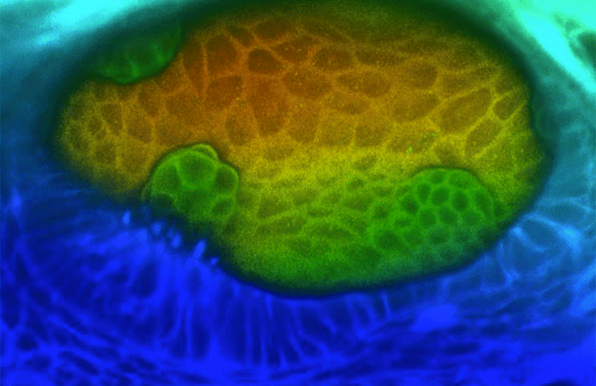 A time lapse microscope image of cells forming the semicircular canals 
