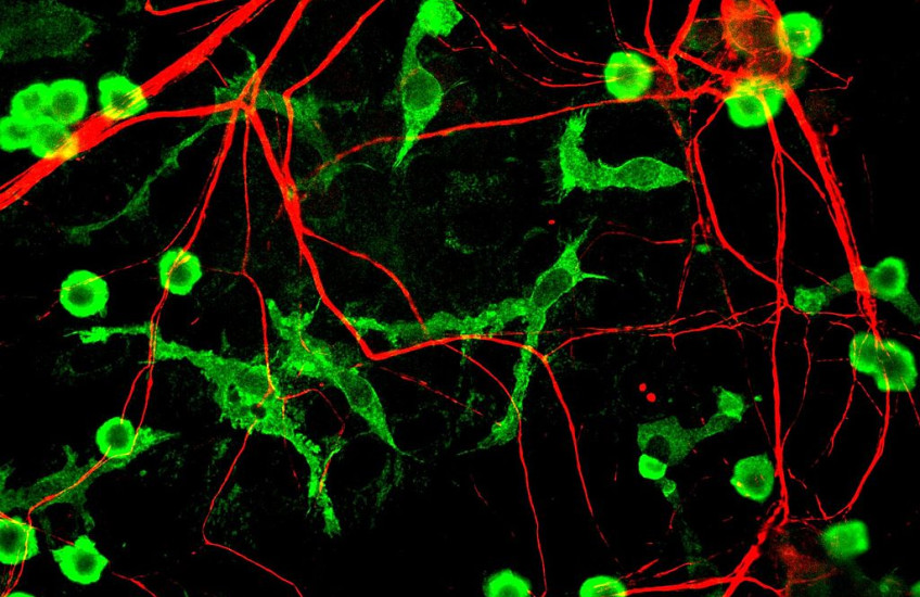 microglia