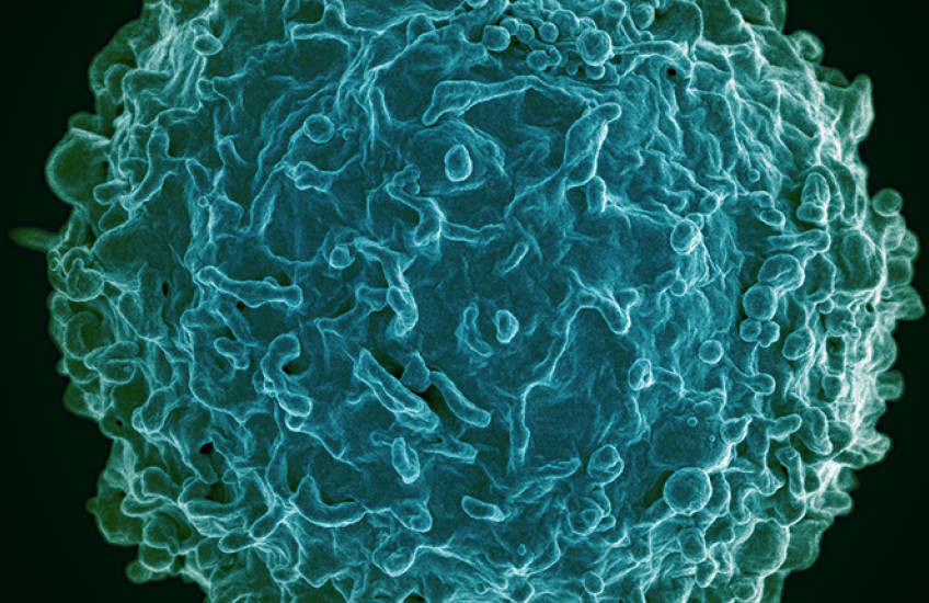 Magnified image of a spherical cell with many protrusions on its surface, colored blue-green