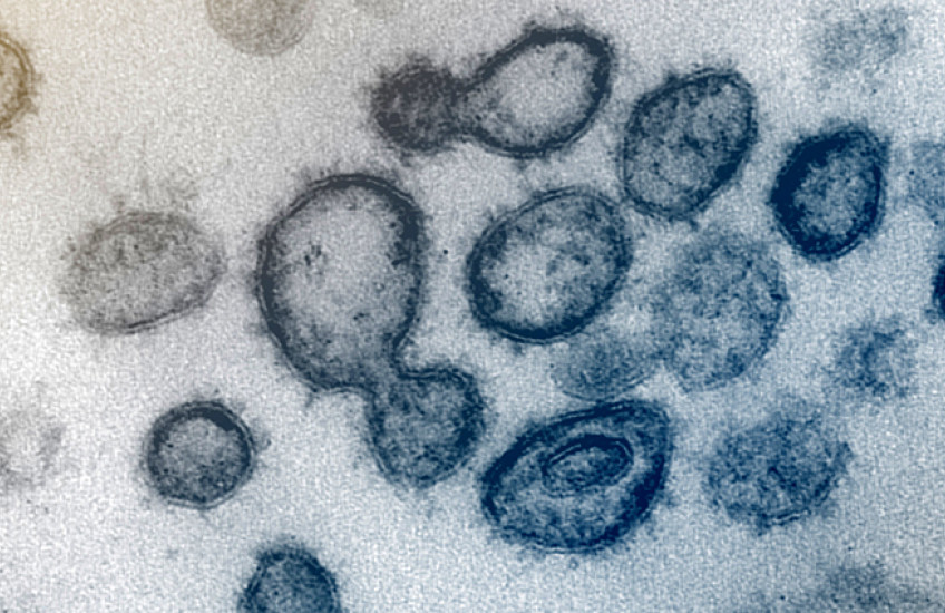 Microscope image of virus particles in blue against a pale background