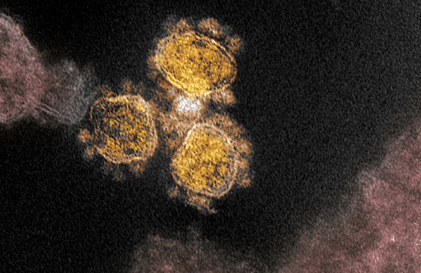 Colorized micrograph of three SARS-CoV-2 viral particles against a dark background