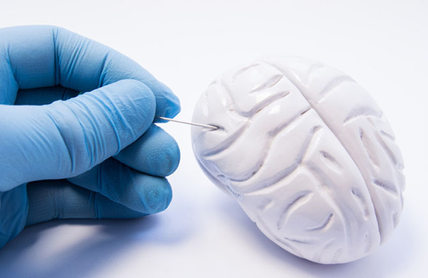 A gloved hand examines a small model of a brain