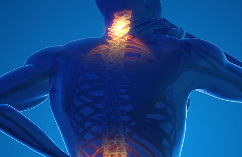 Illustration of human back with areas of inflammation highlighted