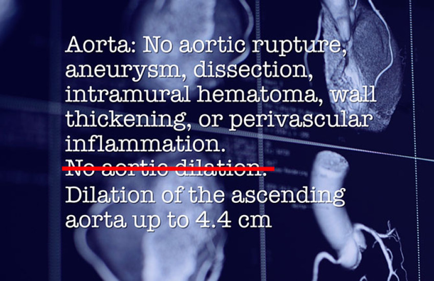 Text over angled view of CT scans of the heart