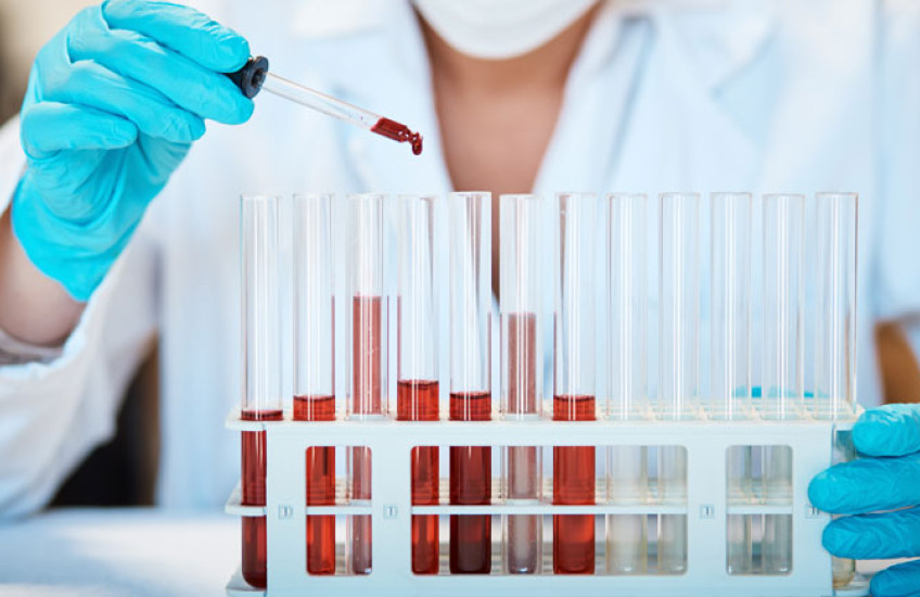 Photo of a person in a lab coat holding an eye dropper of blood over some glass vials 