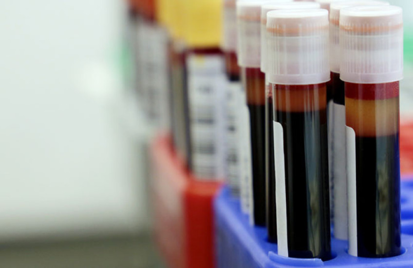 Test tube vials filled with red liquid 