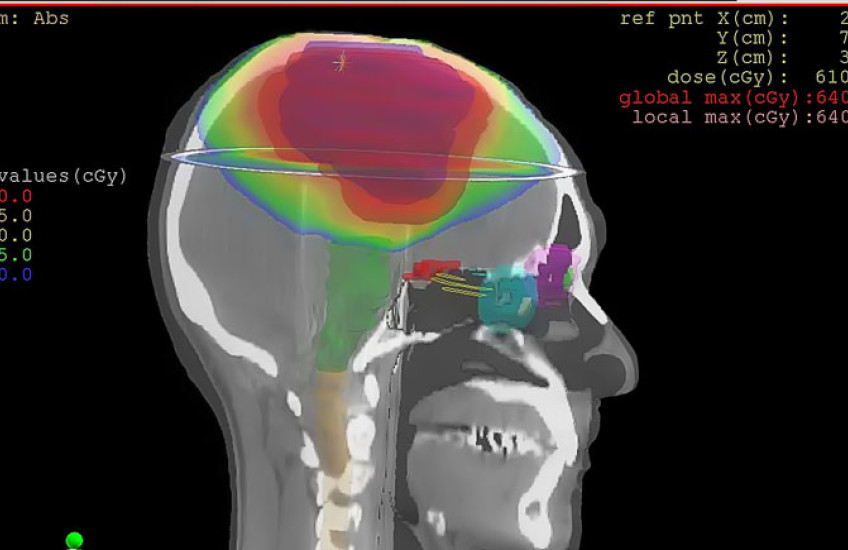 MRI-type of image of brain scan, profile view 