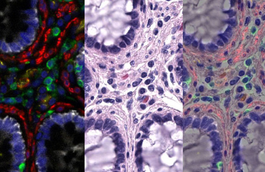 Three side-by-side images of the same starlike arrangement of cells, each in different colors