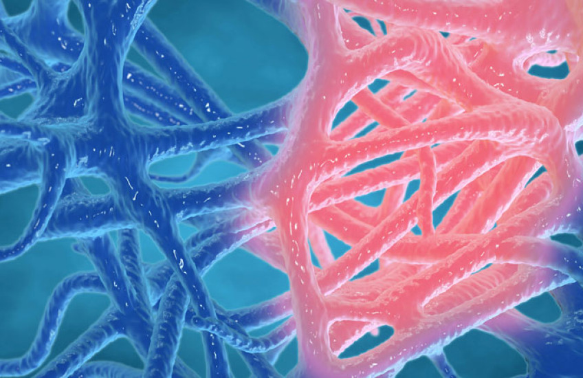 Illustration of inflammation, with some nerve endings pink, the rest blue