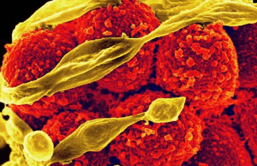 Staphylococcus aureus bacteria that have developed resistance to the antibiotic methicillin. Image: NIAID