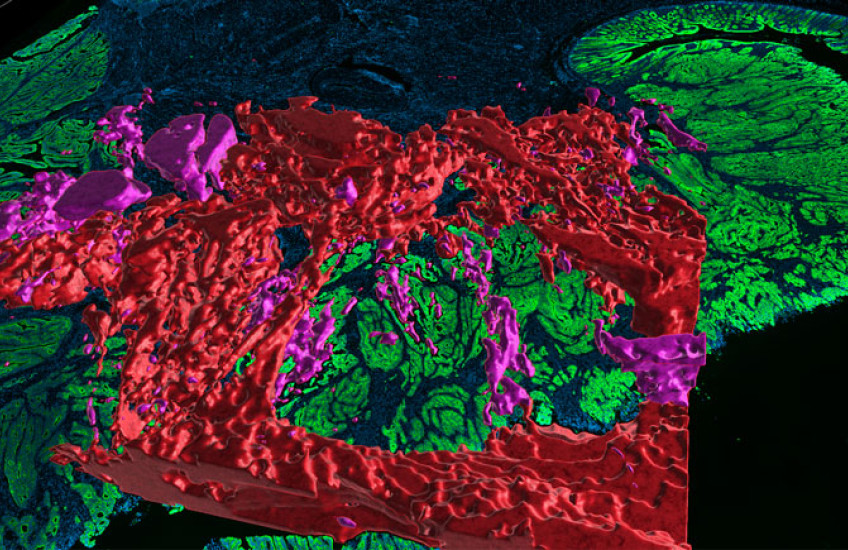 3D red and pink patches on top of a 2D green and blue area