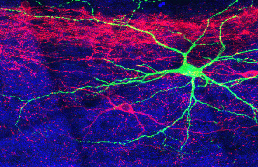 Patches of bright pink, purple, and green representing different types of neurons