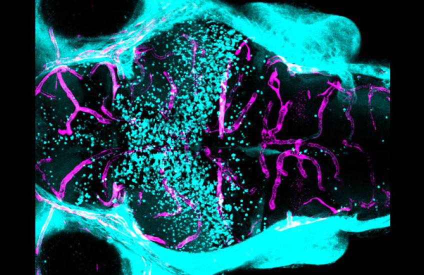 A blue, black, and pink image of a zebrafish brain