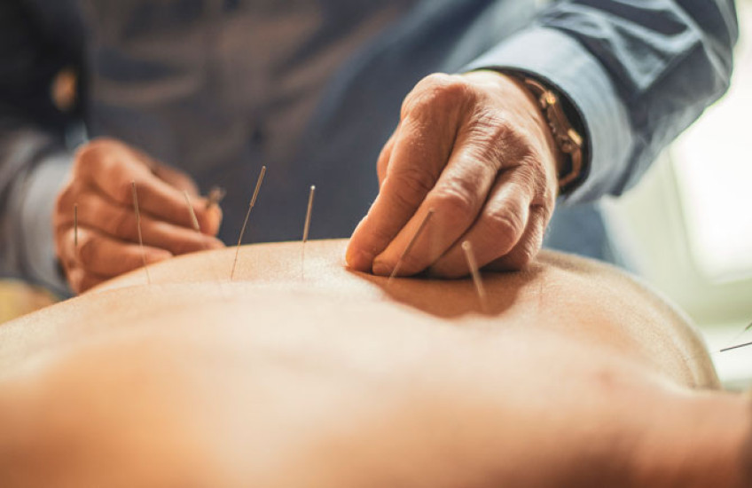 An acupuncturist inserts needles into a patient's back