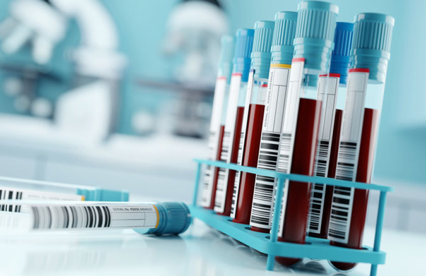 A rack of tubes containing blood samples, with two empty tubes lying down