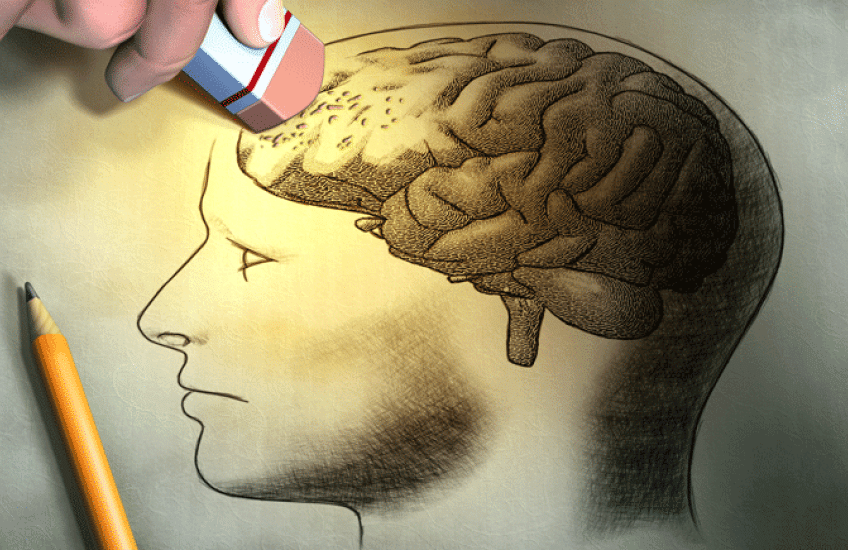 A drawing of a brain inside a human head, with the front portion of the brain being erased
