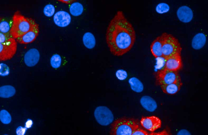 Human beta cells and insulin granules 