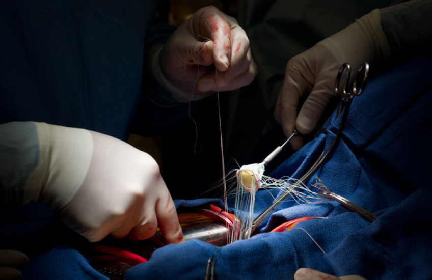 Image of a heart surgery procedure
