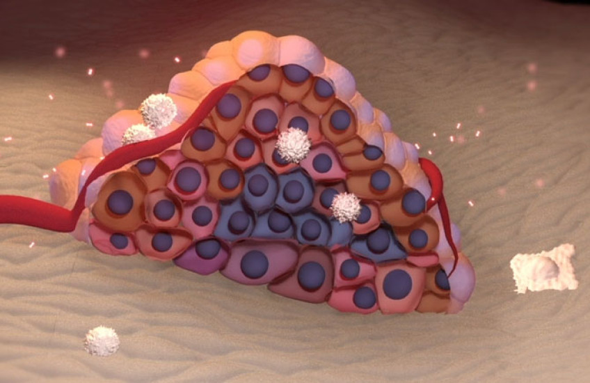 An illustration of a cluster of cancer cells forming a tumor