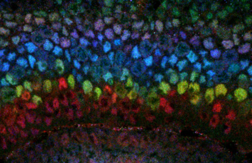 Layers of different colored dots, representing cells