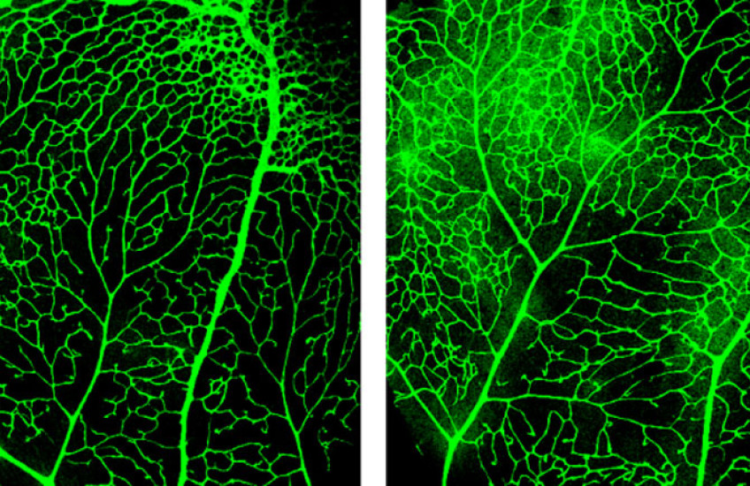 A pair of microscope photos showing blood vessels in the blood-retina barrier dyed green with fluorescent dye