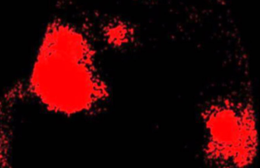 Irregular red patches representing dopamine on a black background that is the brain